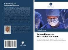 Borítókép a  Behandlung von Rektumkarzinomen - hoz