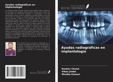 Couverture de Ayudas radiográficas en implantología