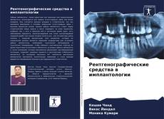 Capa do livro de Рентгенографические средства в имплантологии 