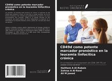 Copertina di CD49d como potente marcador pronóstico en la leucemia linfocítica crónica