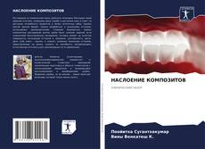 Couverture de НАСЛОЕНИЕ КОМПОЗИТОВ