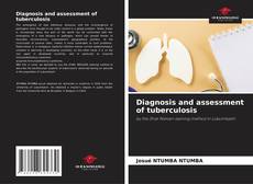 Diagnosis and assessment of tuberculosis kitap kapağı