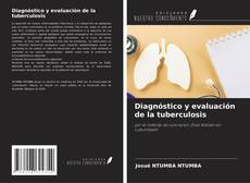 Couverture de Diagnóstico y evaluación de la tuberculosis