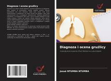 Bookcover of Diagnoza i ocena gruźlicy