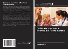 Copertina di Caries de la primera infancia en Tirana Albania