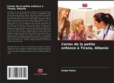 Bookcover of Caries de la petite enfance à Tirana, Albanie