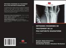 Borítókép a  MÉTHODES MODERNES DE TRAITEMENT DE LA POLYARTHRITE RHUMATOÏDE - hoz