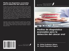 Copertina di Medios de diagnóstico avanzados para la detección del cáncer oral