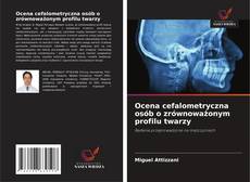 Bookcover of Ocena cefalometryczna osób o zrównoważonym profilu twarzy