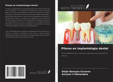 Couverture de Pilares en implantología dental