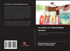 Bookcover of Les piliers en implantologie dentaire