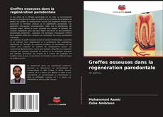 Capa do livro de Greffes osseuses dans la régénération parodontale 