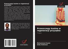 Borítókép a  Przeszczepy kostne w regeneracji przyzębia - hoz