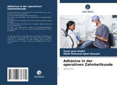 Borítókép a  Adhäsive in der operativen Zahnheilkunde - hoz