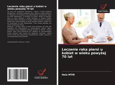 Copertina di Leczenie raka piersi u kobiet w wieku powyżej 70 lat