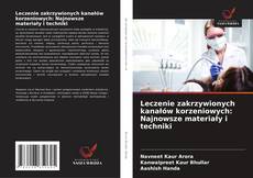 Portada del libro de Leczenie zakrzywionych kanałów korzeniowych: Najnowsze materiały i techniki