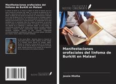 Buchcover von Manifestaciones orofaciales del linfoma de Burkitt en Malawi
