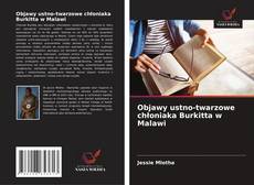 Buchcover von Objawy ustno-twarzowe chłoniaka Burkitta w Malawi