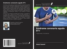 Capa do livro de Síndrome coronario agudo ST+ 