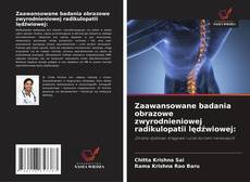 Zaawansowane badania obrazowe zwyrodnieniowej radikulopatii lędźwiowej: kitap kapağı