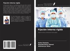 Buchcover von Fijación interna rígida