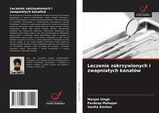 Обложка Leczenie zakrzywionych i zwapniałych kanałów