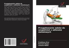 Обложка Przygotowanie zębów do uzupełnień z odlewów metalowych