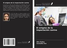 Copertina di El enigma de la impactación canina