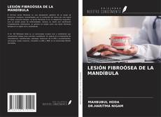 LESIÓN FIBROÓSEA DE LA MANDÍBULA的封面