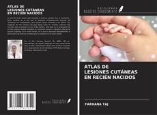 Capa do livro de ATLAS DE LESIONES CUTÁNEAS EN RECIÉN NACIDOS 
