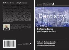 Capa do livro de Enfermedades periimplantarias 