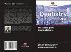 Maladies péri-implantaires的封面