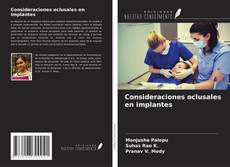 Capa do livro de Consideraciones oclusales en implantes 