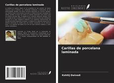 Capa do livro de Carillas de porcelana laminada 