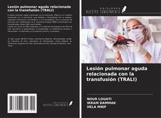 Couverture de Lesión pulmonar aguda relacionada con la transfusión (TRALI)
