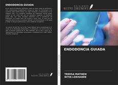 Capa do livro de ENDODONCIA GUIADA 