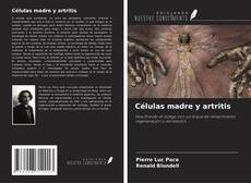 Capa do livro de Células madre y artritis 