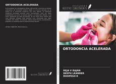 Capa do livro de ORTODONCIA ACELERADA 