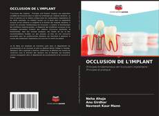 Copertina di OCCLUSION DE L'IMPLANT