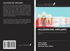 Capa do livro de OCLUSIÓN DEL IMPLANTE 