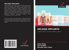 Capa do livro de OKLUZJA IMPLANTU 