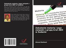 Couverture de Zakażenie malarią i jego związek z grupą krwi ABO w Sudanie