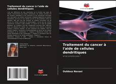 Copertina di Traitement du cancer à l'aide de cellules dendritiques