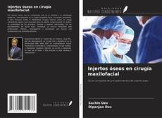 Capa do livro de Injertos óseos en cirugía maxilofacial 