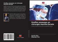 Bookcover of Greffes osseuses en chirurgie maxillo-faciale