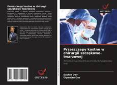 Bookcover of Przeszczepy kostne w chirurgii szczękowo-twarzowej