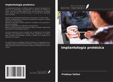 Capa do livro de Implantología protésica 