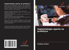 Bookcover of Implantologia oparta na protetyce