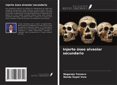 Capa do livro de Injerto óseo alveolar secundario 