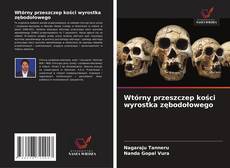Обложка Wtórny przeszczep kości wyrostka zębodołowego